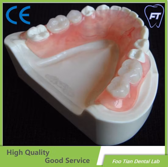 Selling Cast Partial Framework Denture Removable Restoration
