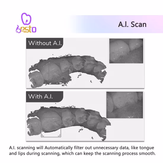 Escáner dental 3D de productos médicos elegantes para ortodoncia