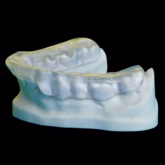 Coronas dentales de laboratorio dental de China con dentadura postiza Rpd