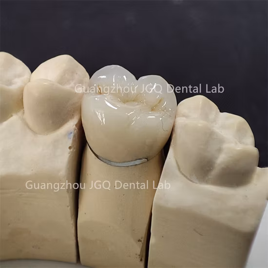 Coronas digitales Pfm